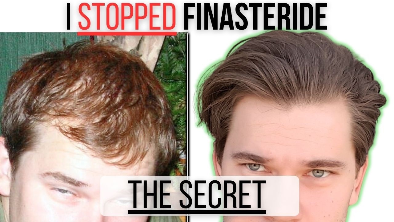 Вот как я прекратил принимать финастерид, не потеряв при этом волосы.