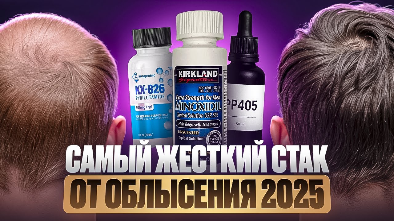 Мой нынешний стак от облысения 2026