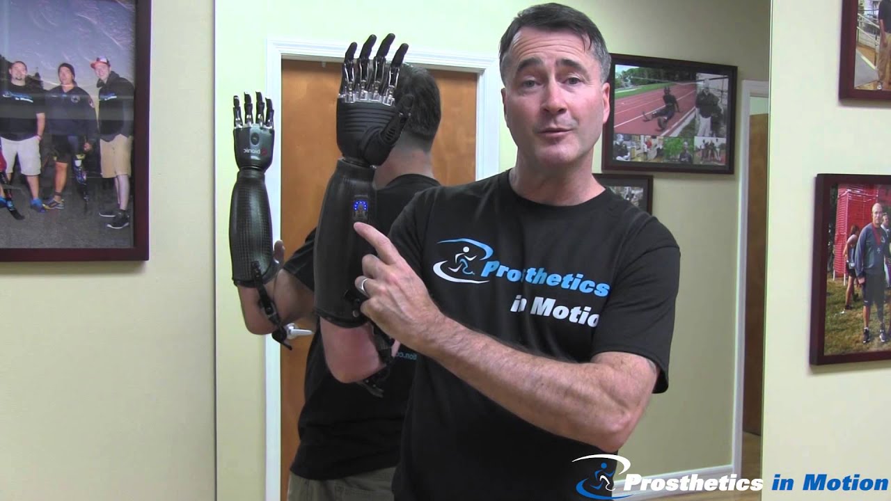 Below The Elbow Amputee Demonstrates BeBionic 3 Myoelectric Prosthesis