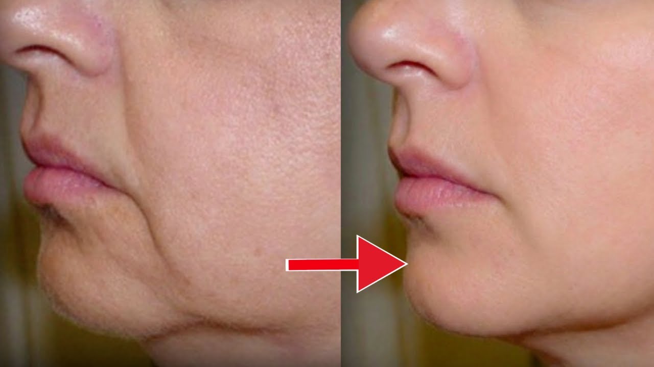 Lift Sagging Cheeks Naturally in 10 Minutes | Instant Face Yoga Routine