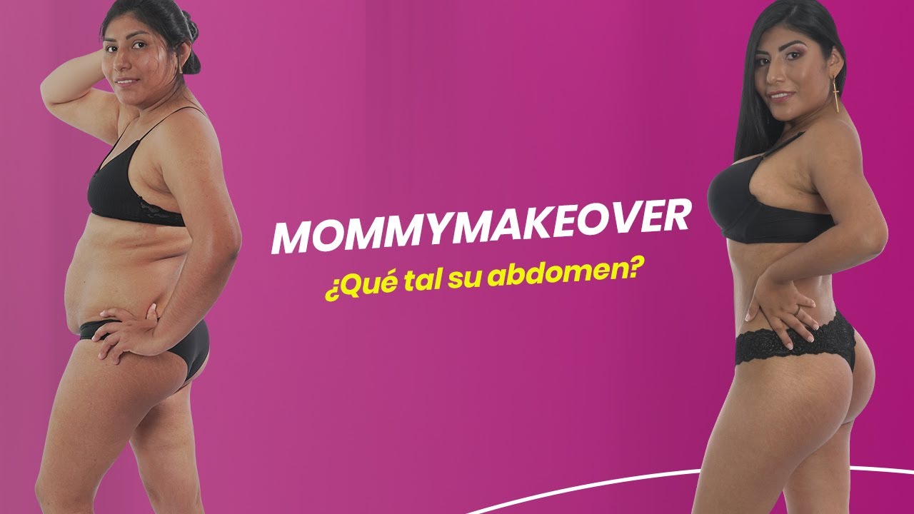 MOMMYMAKEOVER ¿QUÉ TAL SU ABDOMEN?