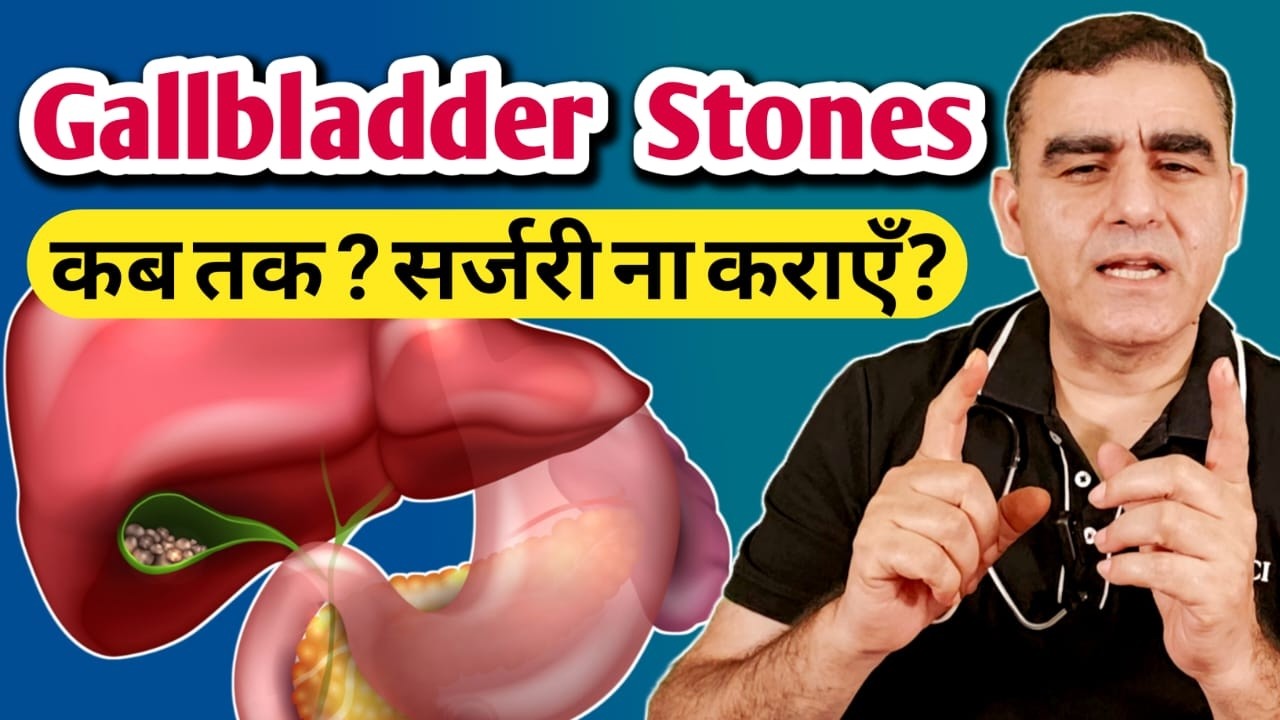 गॉल ब्लैडर सर्जरी कब करानी चाहिए और कब नहीं?  | 5 Reasons To DELAY Gallbladder Surgery