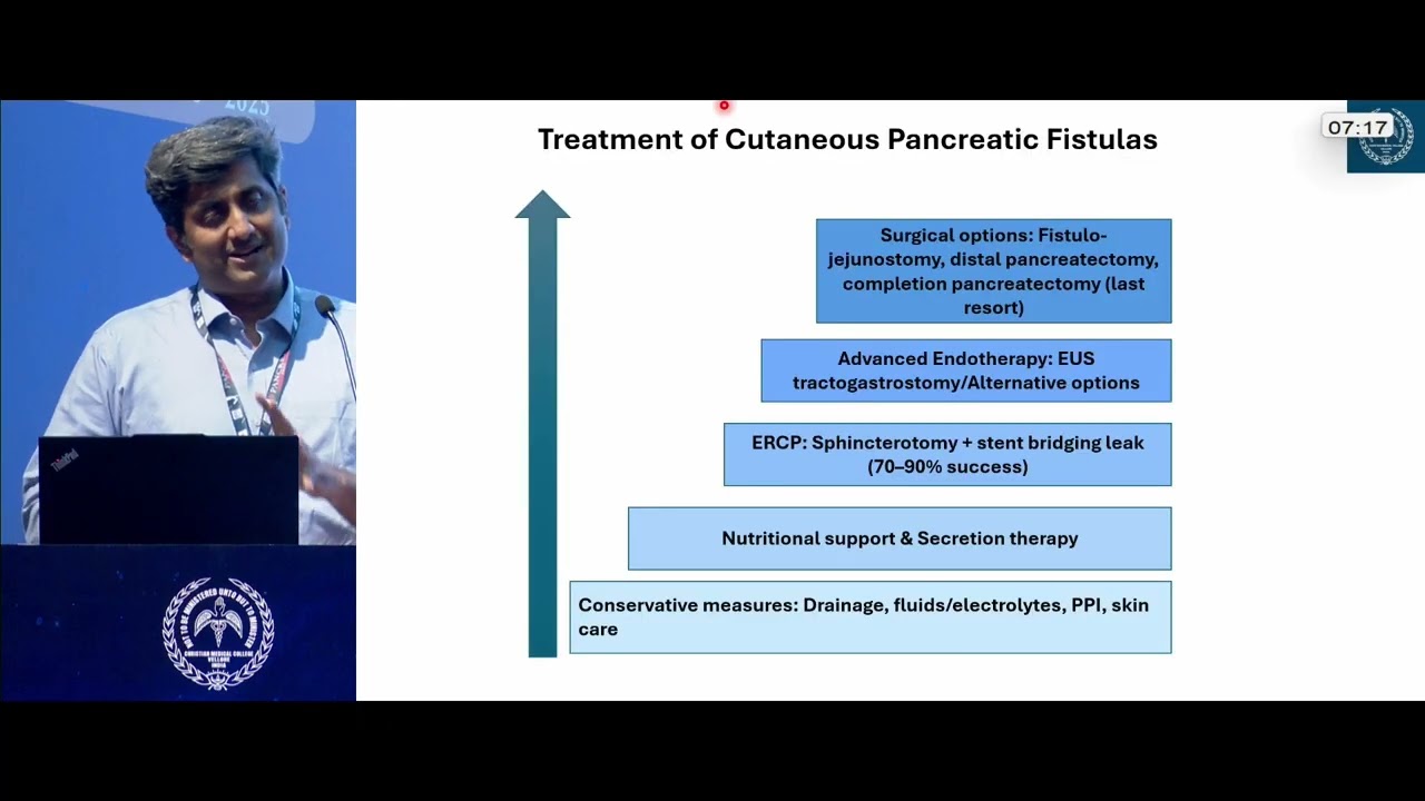 External pancreatic fistula - options of therapy |  Dr  Reuben Thomas