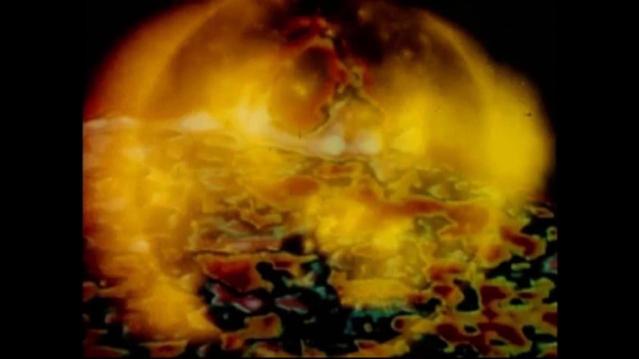 Liquom - Microsphere