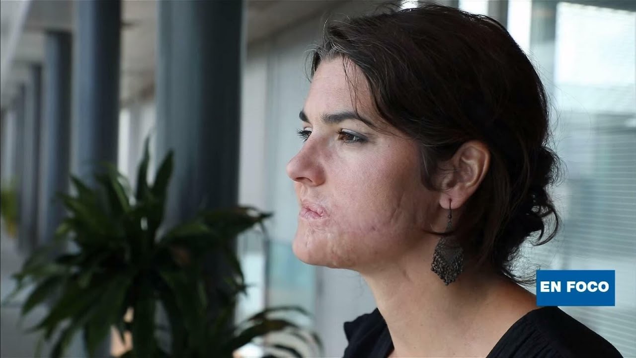 El coraje y la resiliencia de una sobreviviente del 13 de noviembre de 2015