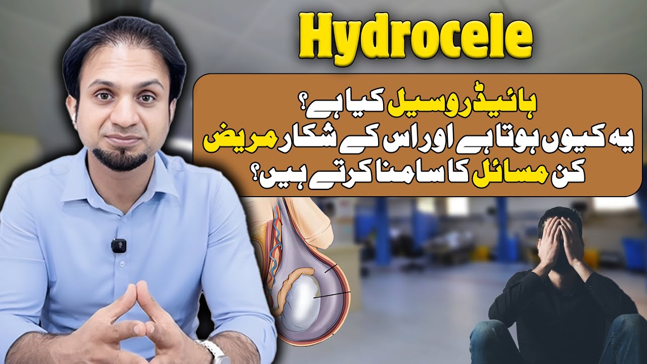 What Is Hydrocele? Causes, Symptoms, and Problems Patients Face | Dr. Faisal Anis Malik.