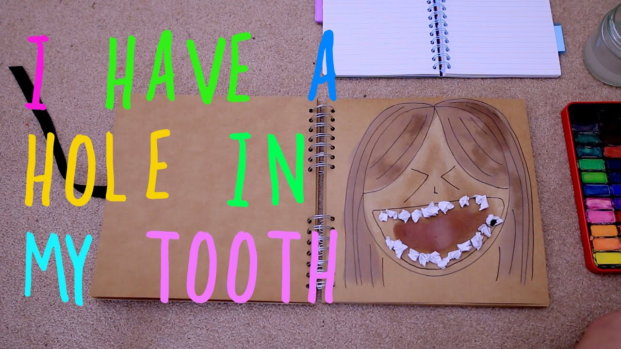 I Have A Hole In My Tooth (And My Dentists Are Shut)