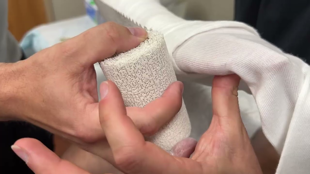 Posterior Splint LA (Plaster) 