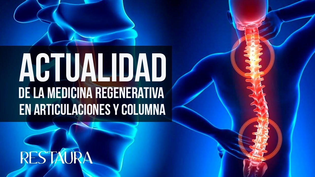 Estado actual del uso de la Medicina Regenerativa en articulaciones y columna vertebral
