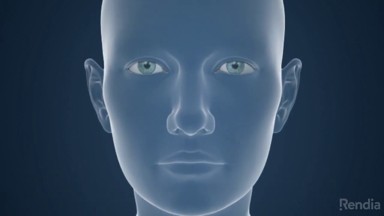 Fluorescein Angiography