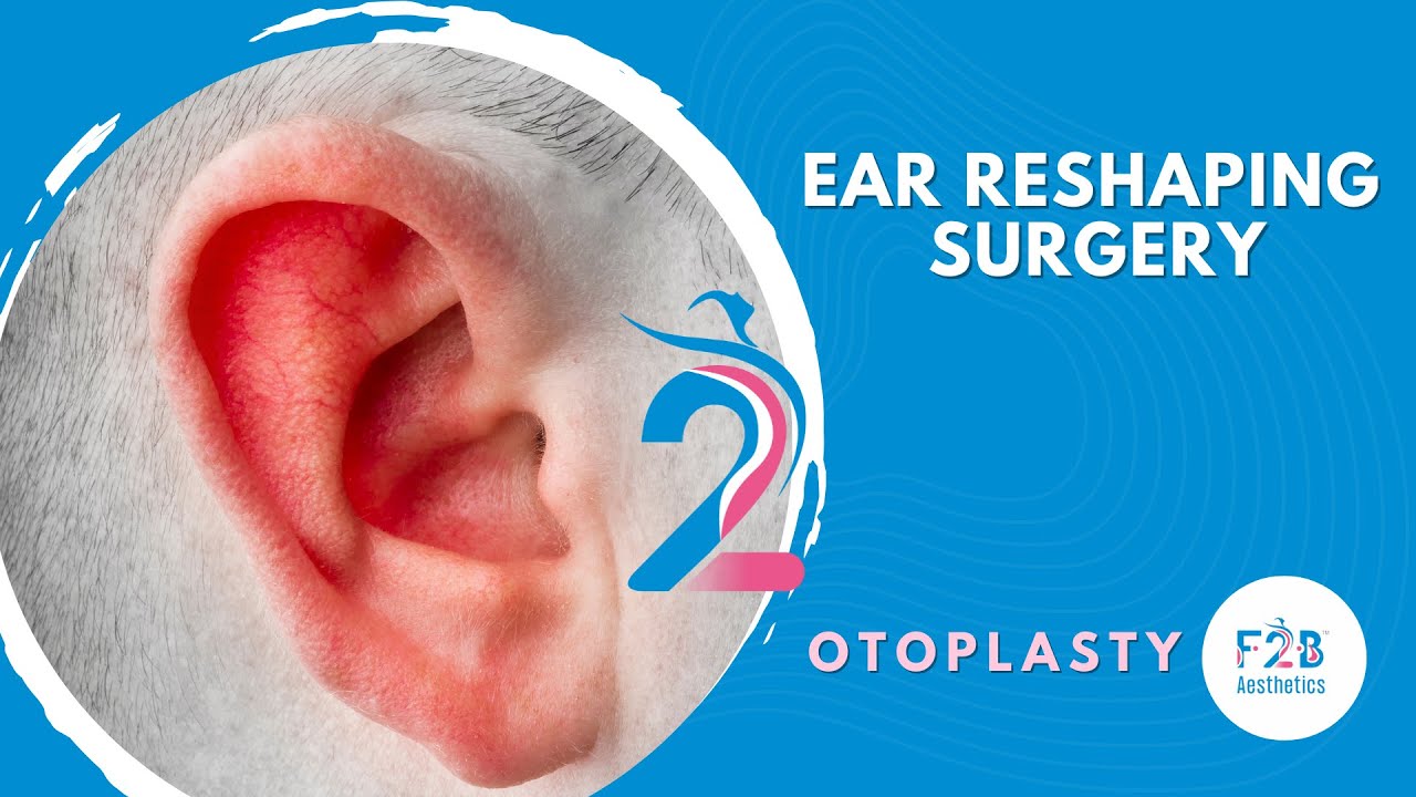 Ear Reshaping | Otoplasty | Plastic Surgery Of Ear