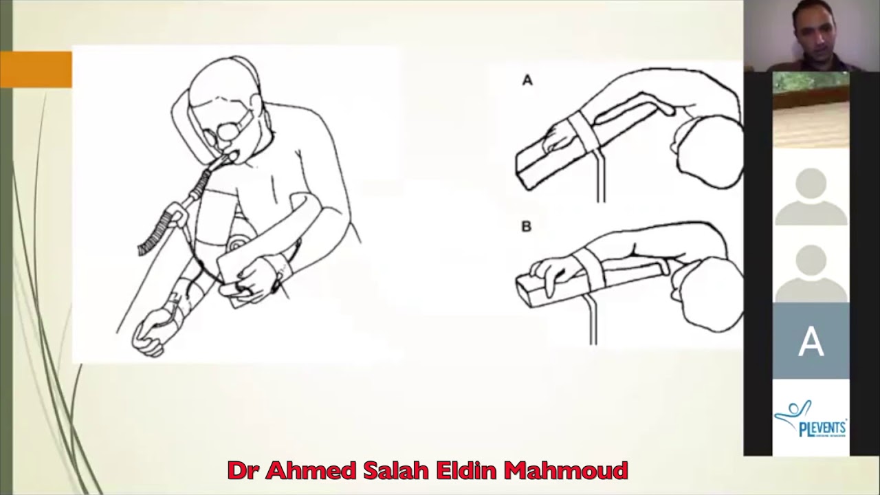 Complications  of Positioning in  Neurosurgeries by Dr Ahmed Salah Eldin Mahmoud