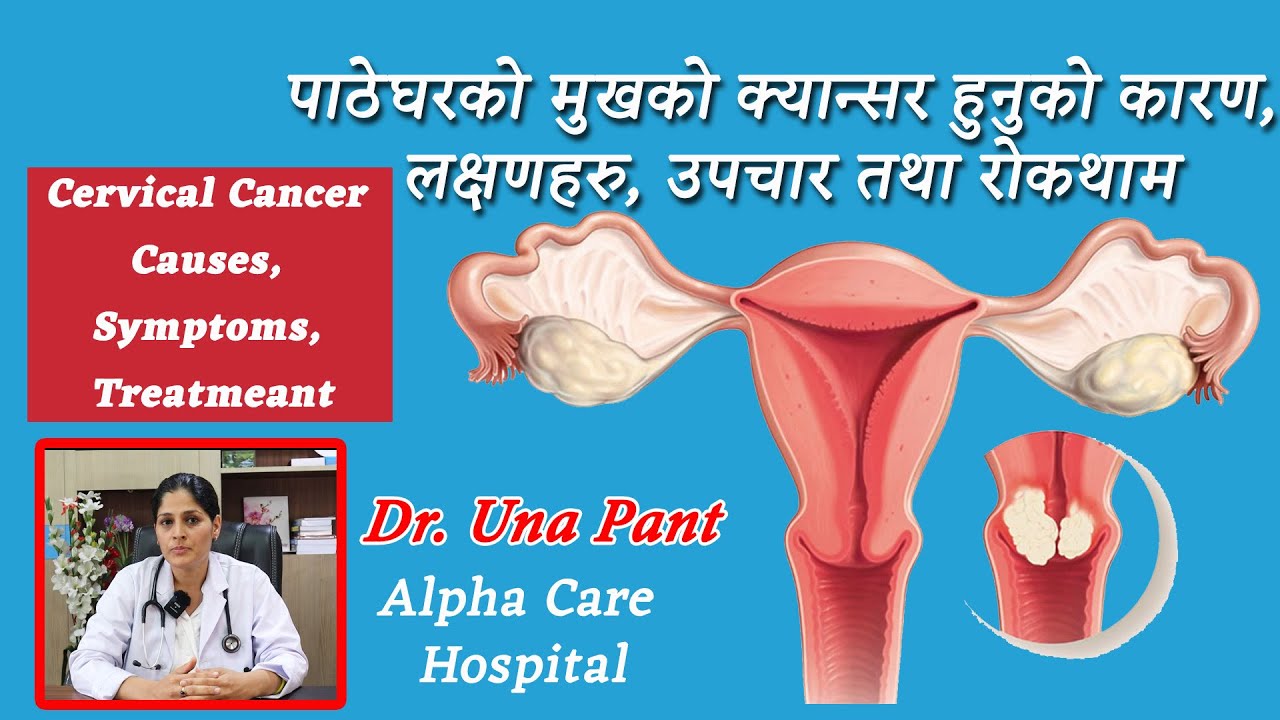 कसरी हुन्छ पाठेघरको मुखको क्यान्सर | Causes, symptoms, stage,  treatment of cervical cancer in women