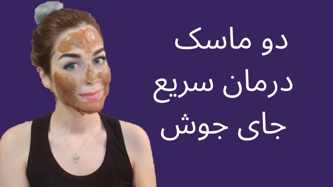 Acne scar removal - ماسک جوش صورت - بهترین ماسک برای جای جوش😊