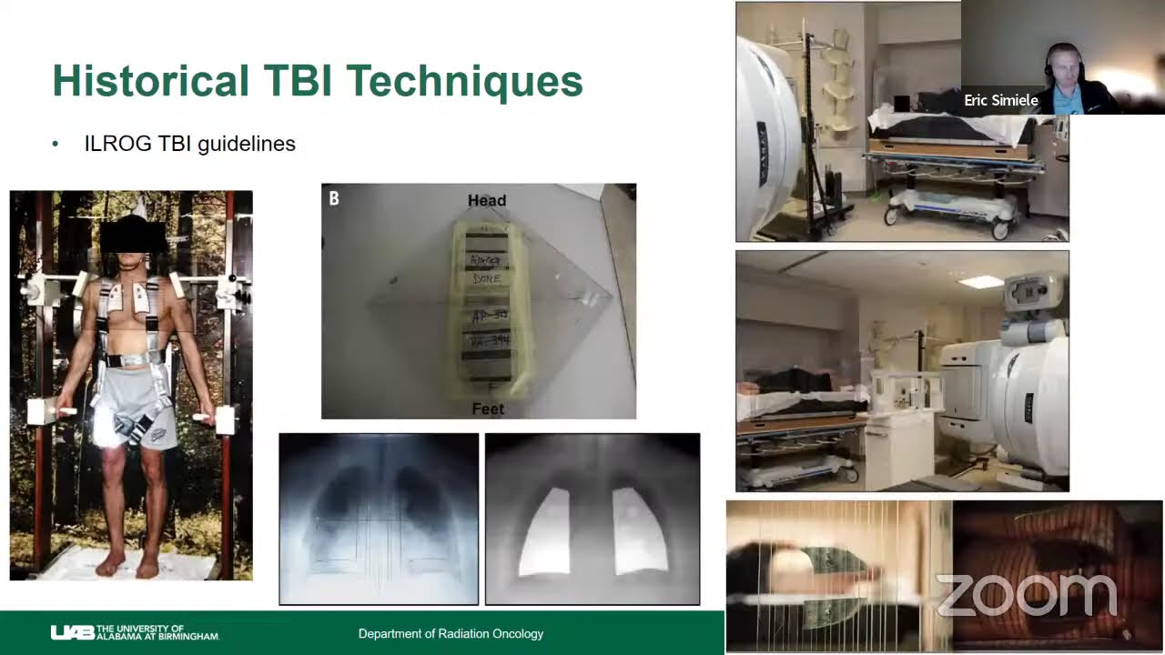 NSS 2024.11.01 Eric Simiele "VMAT Total Body Irradiation"