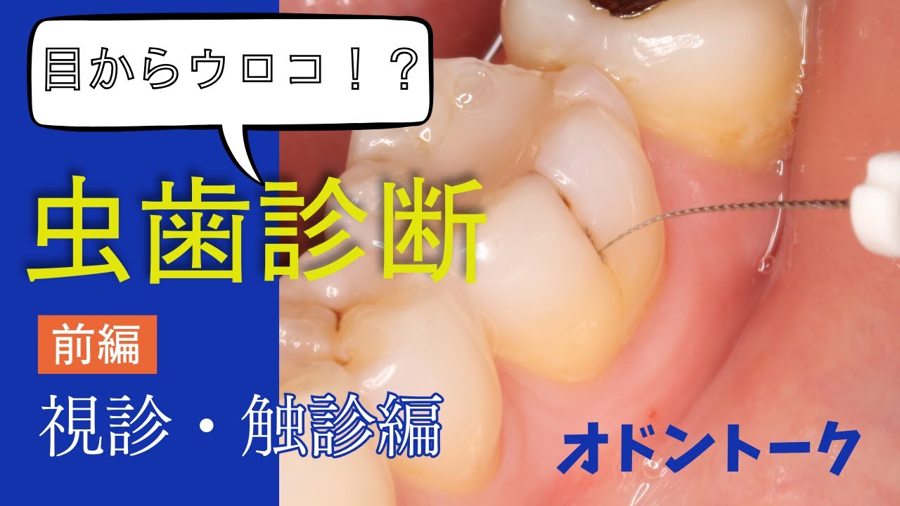 カリエストーク第１弾！視診、触診について語ります。カリエストーク前半