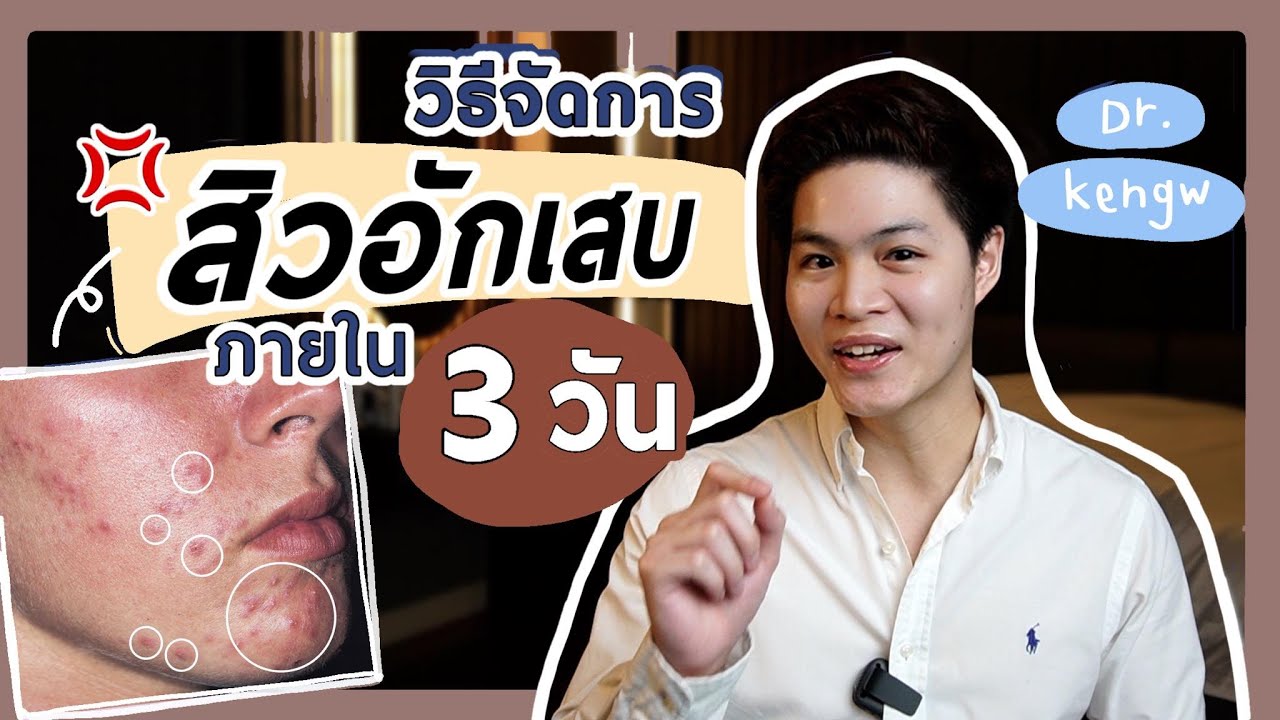 จัดการสิวอักเสบ ภายใน 3 วัน