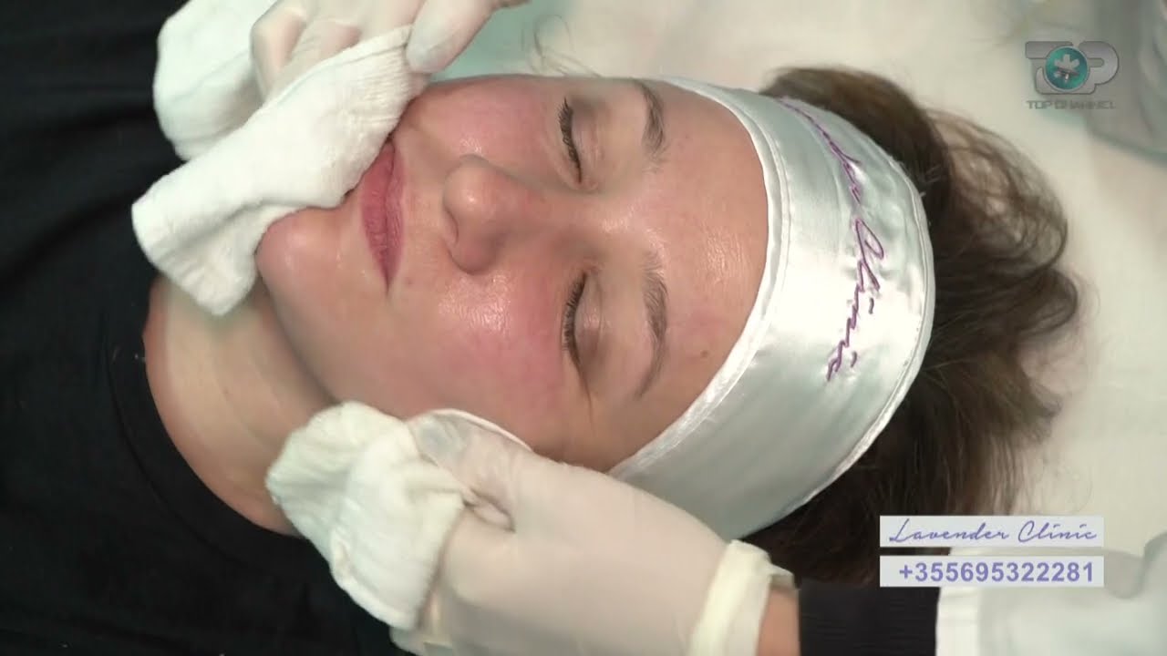 Hipokrati- Trajtim live me peeling kimik, përfitimet dhe sa herë duhet ta bëni!