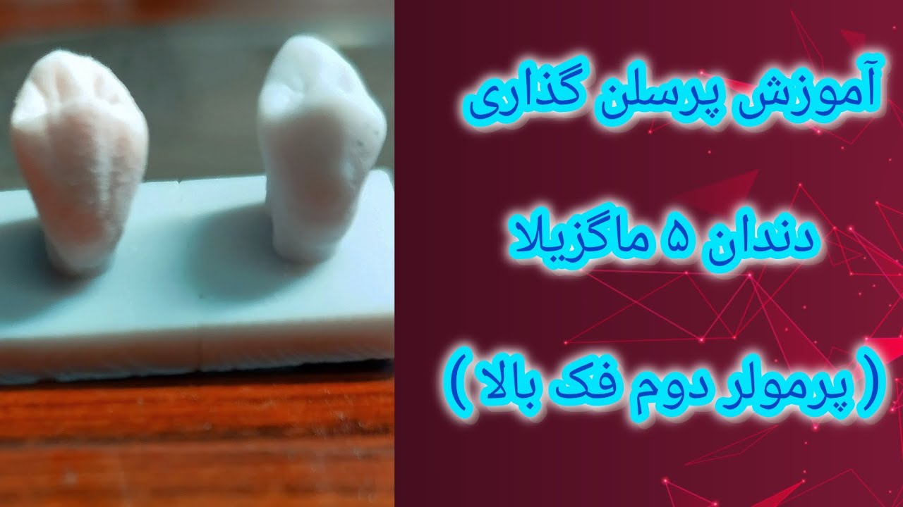 آموزش مرحله به مرحله پرسلن گذاری دندان ۵ فک بالا 🎯🔥| Porcelain build up premolar 5 maxilla 🦷🎨🖌️✨