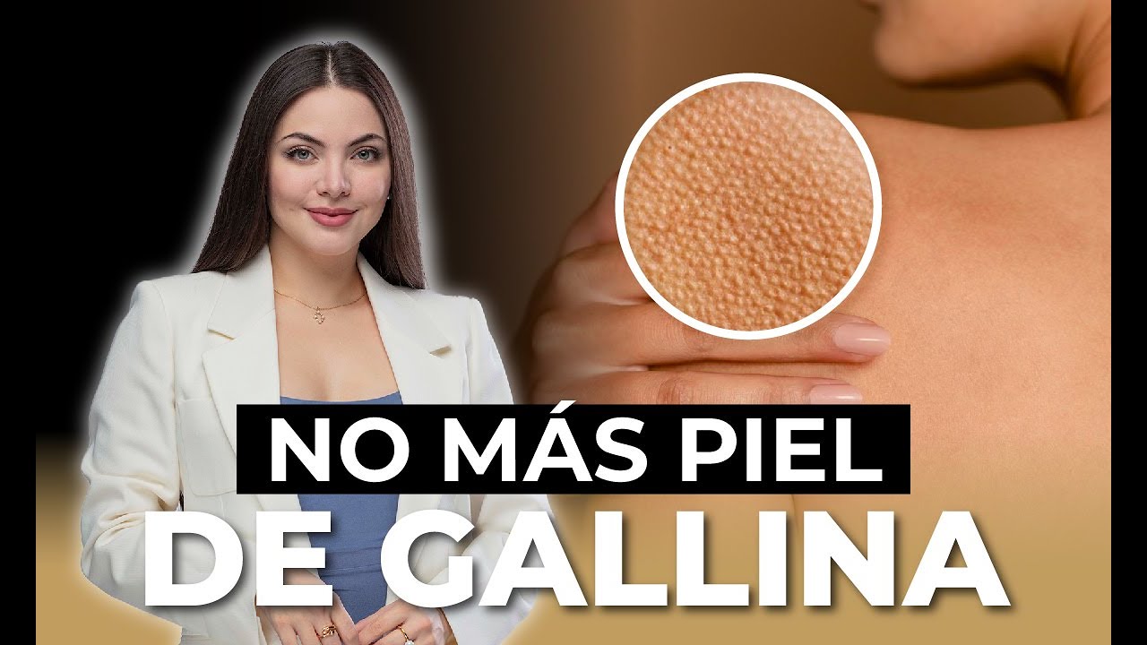 Elimina las 