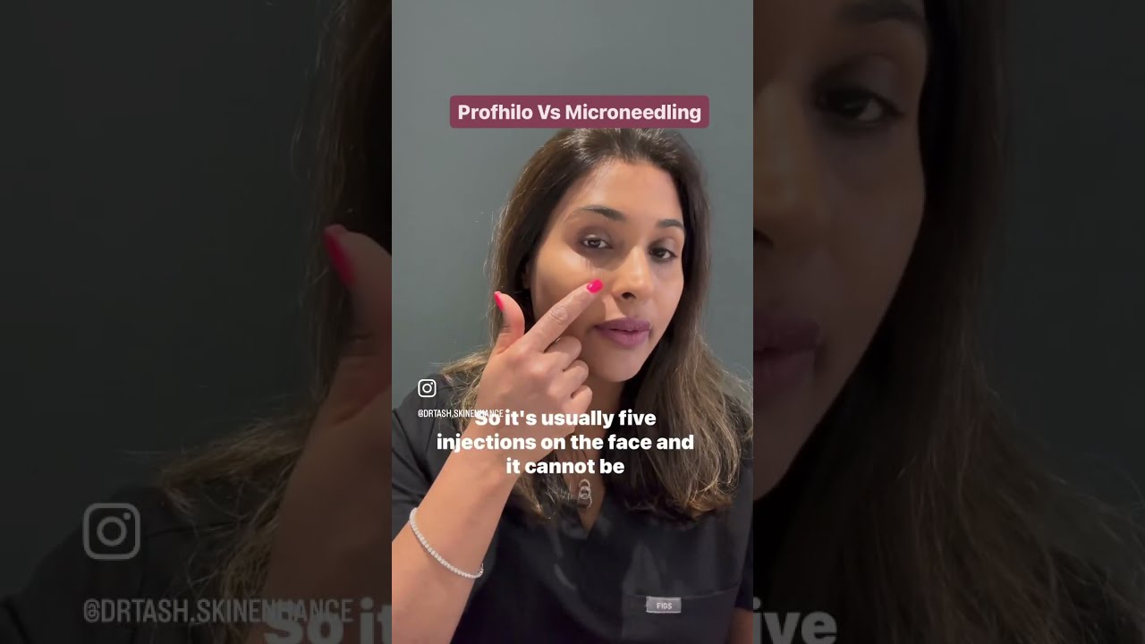What's the difference between microneedling and Profhilo for collagen stimulation?