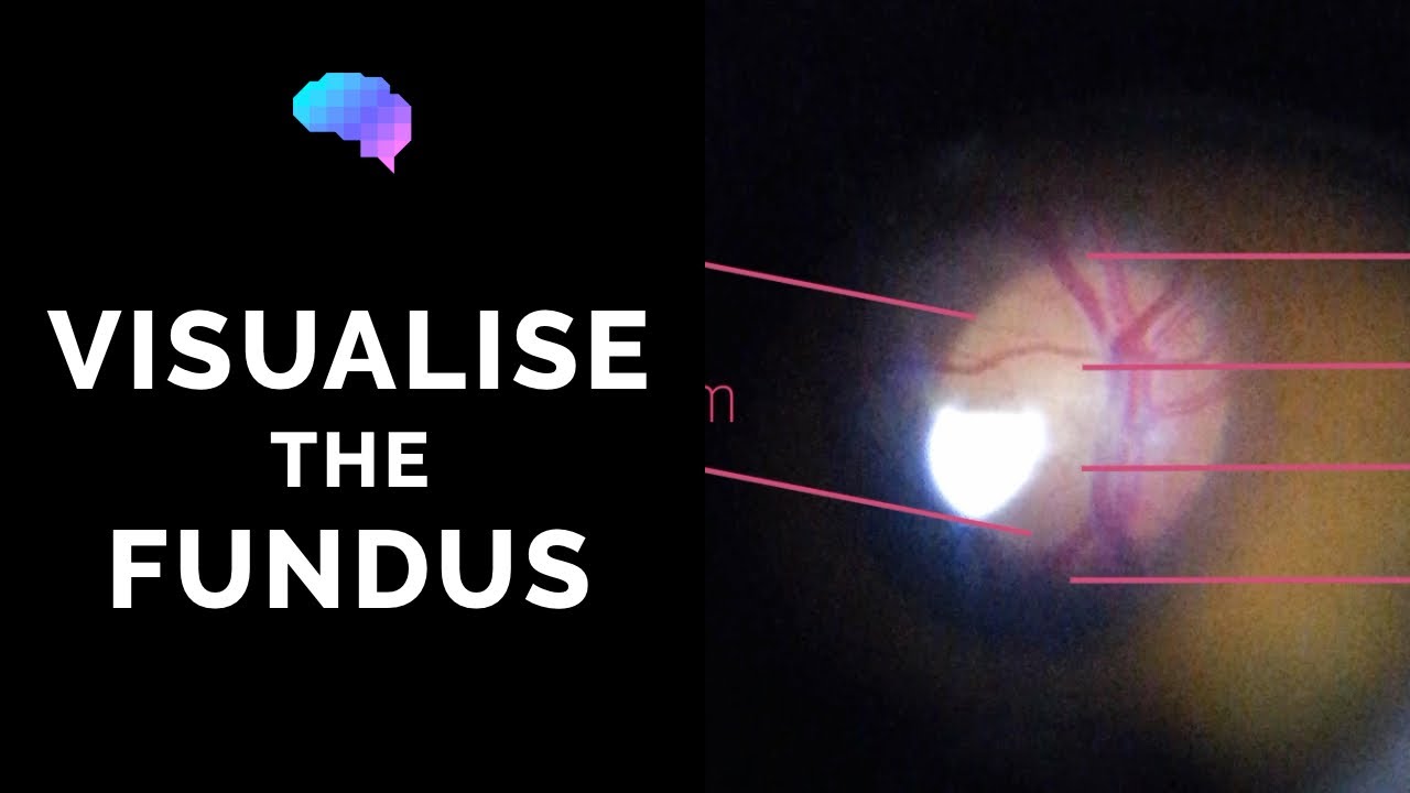 Fundoscopy | How to Visualise the Fundus | Direct Ophthalmoscopy | OSCE Guide | UKMLA | CPSA