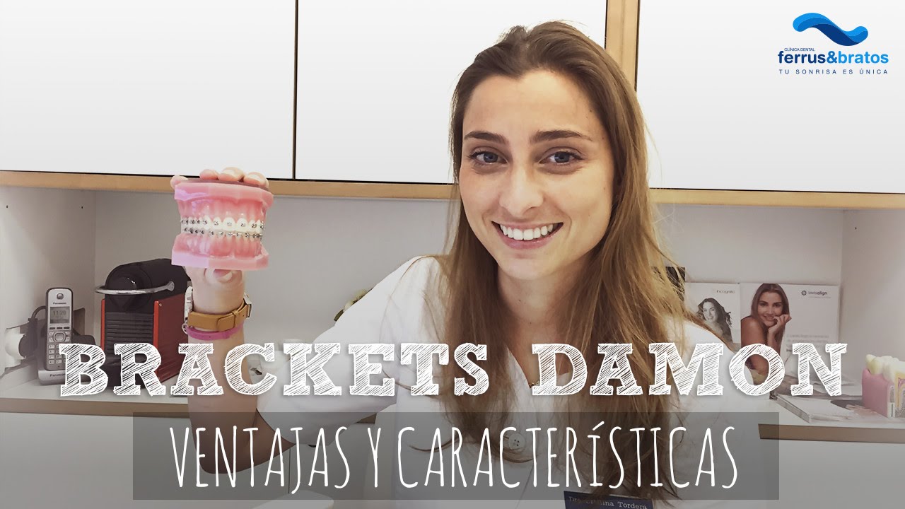 Brackets damon características y ventajas