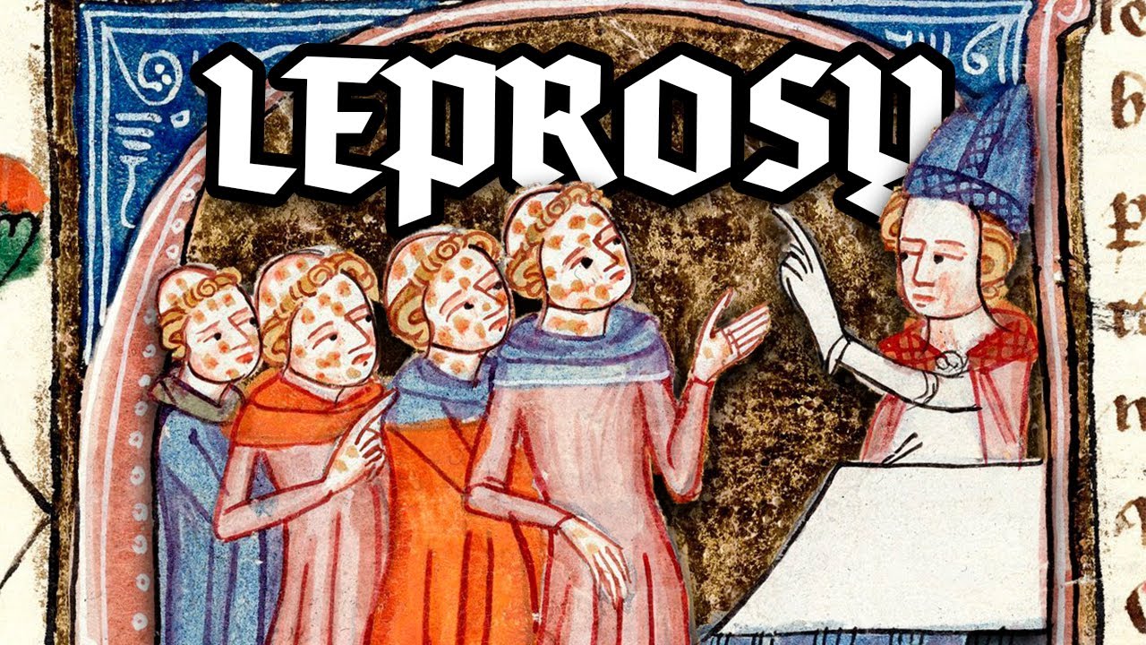 Leprosy in Medieval Europe