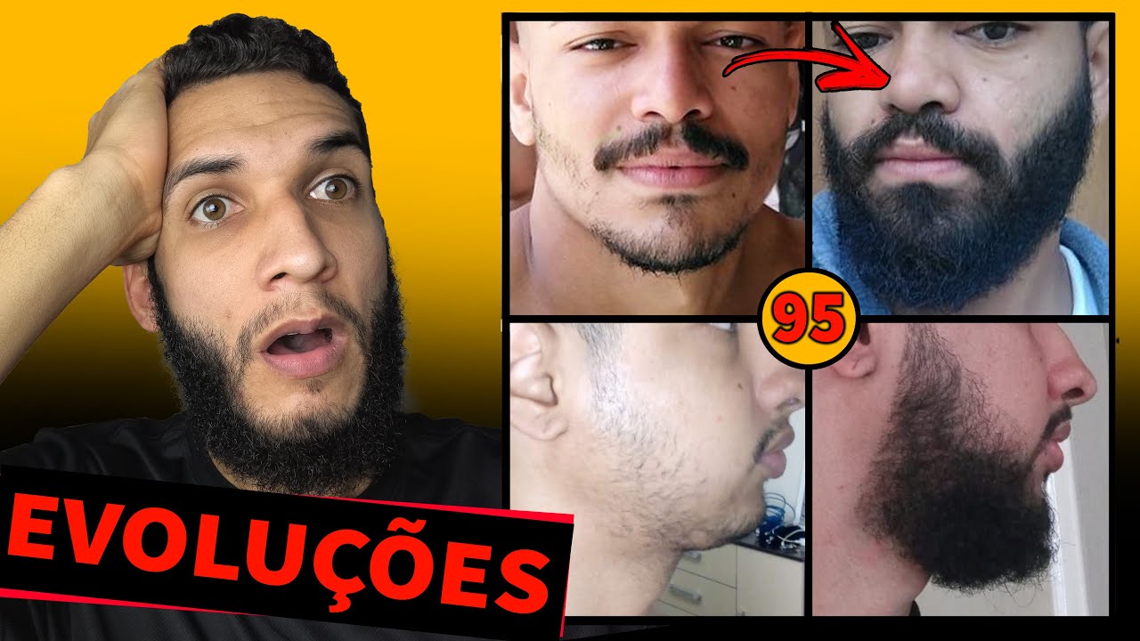 EVOLUÇÃO DOS INSCRITOS / MINOXIDIL #95 🔥