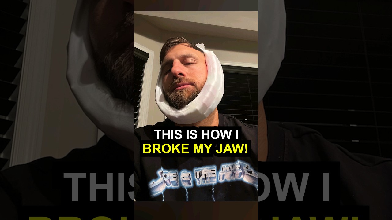 The Painful Truth About My Broken Jaw Story