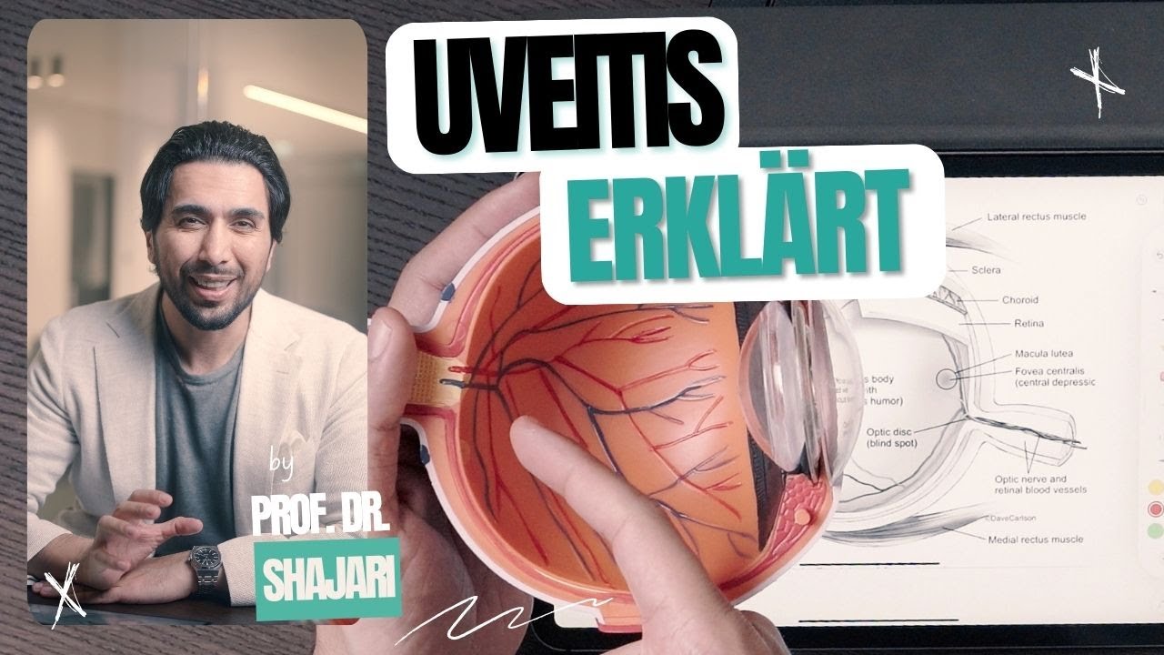 Verschwommenes Sehen, erhöhte Lichtempfindlichkeit - Uveitis einfach erklärt
