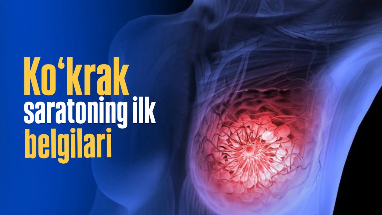 Koʻkrak saratonining ilk belgilari qanday kechadi?