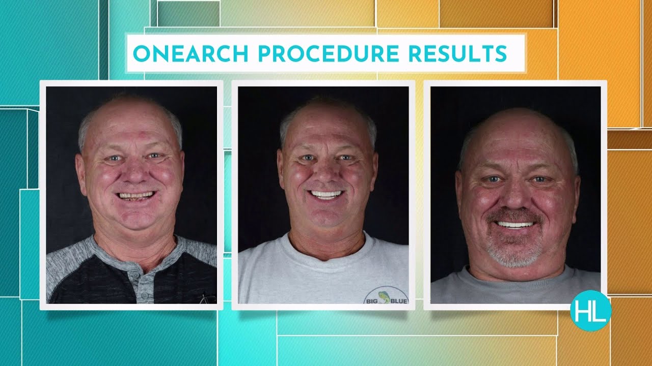 Houston periodontist restoring patients’ smiles with dental implants