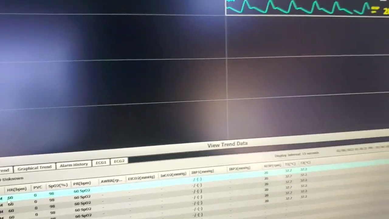 Gen 2b CMS Software: Trend Printing