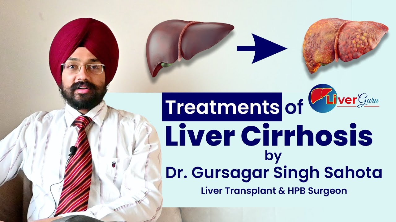 TREATMENT OF LIVER CIRRHOSIS Dr. Gursagar Singh Sahota | Liverguru