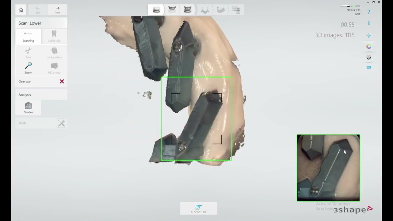3Shape TRIOS - Performing Scan Gauges Scans & Exporting
