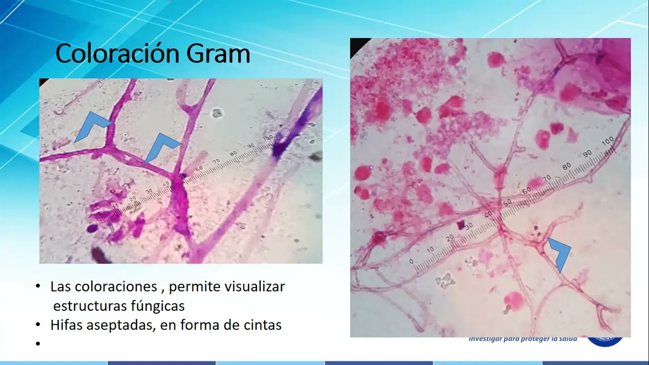 Identificación de mucormicosis “hongo negro”, por métodos microbiológicos