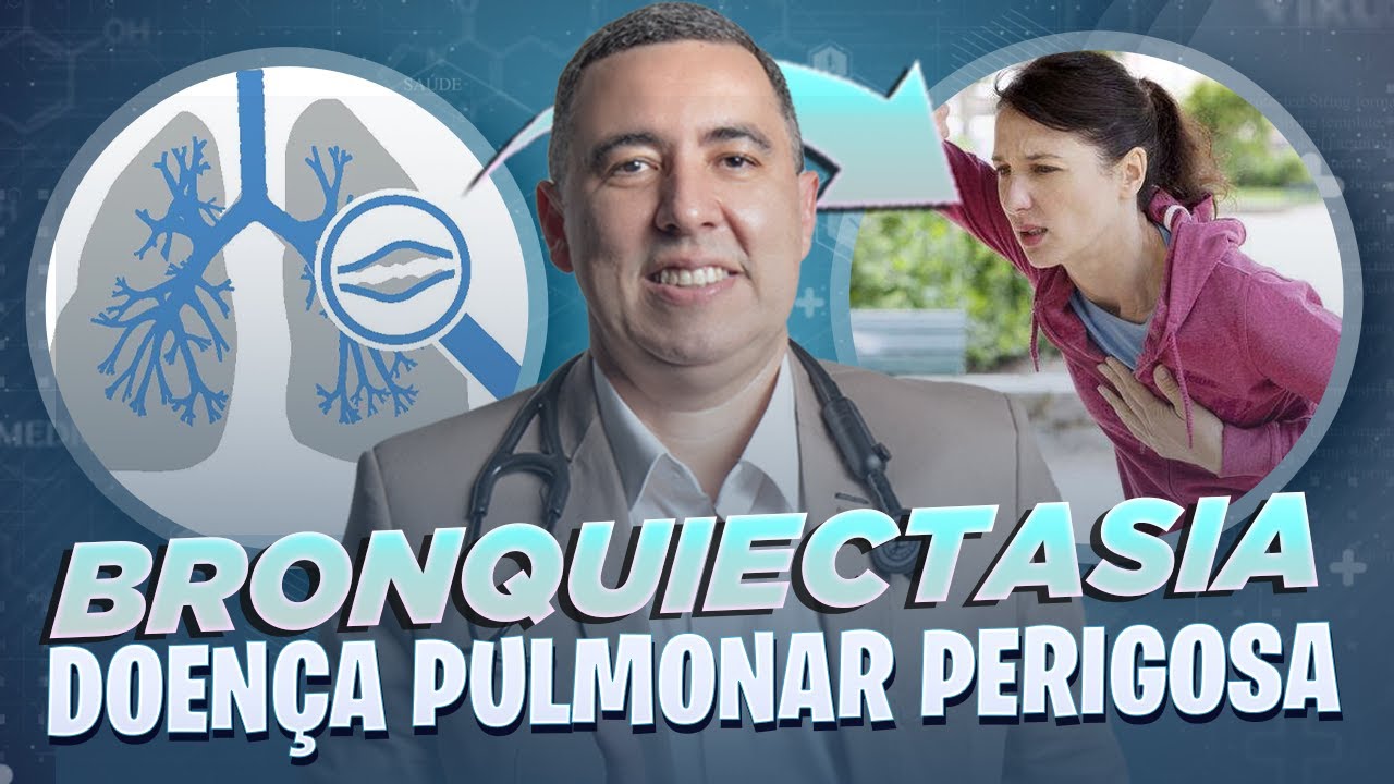 BRONQUIECTASIA tem CURA? Como funciona o TRATAMENTO? Porque ela é tão perigosa? PNEUMO responde