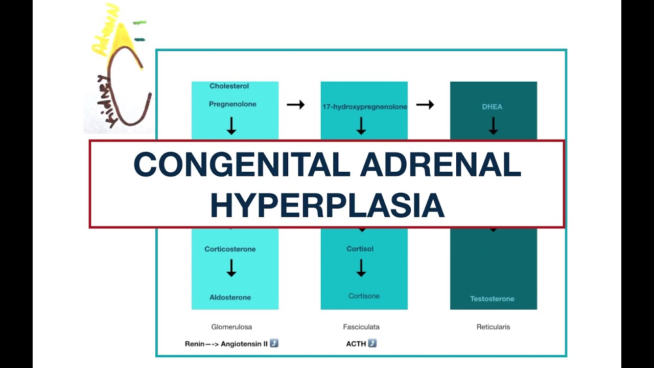 Congenital Adrenal Hyperplasia: Adrenal enzyme deficiencies | MCQs | USMLE