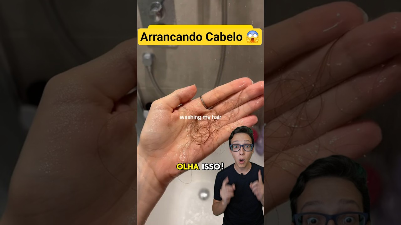 Mania de Arrancar Cabelo 😱 #medicina #medico #enfermagem #enfermeiro #cabeleireira Tricotilomania