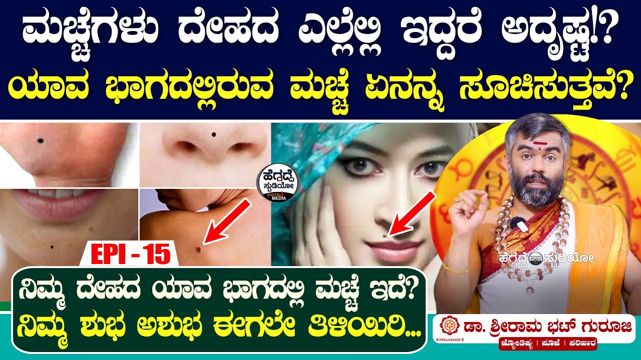 ನಿಮಗೆ ಮಚ್ಚೆಗಳಿವ್ಯಾ? ಮಚ್ಚೆಗಳು ದೇಹದ ಎಲ್ಲೆಲ್ಲಿ ಇದ್ದರೆ ಅದೃಷ್ಟ!? | Sriram Bhat Astrology Epi 15 