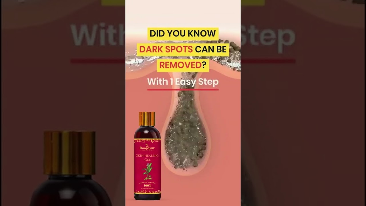 Roopayur Skin Healing Gel 