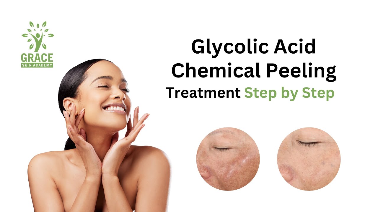 Glycolic acid AHA |  Chemical Peeling Treatment Step by Step #graceskinacademy