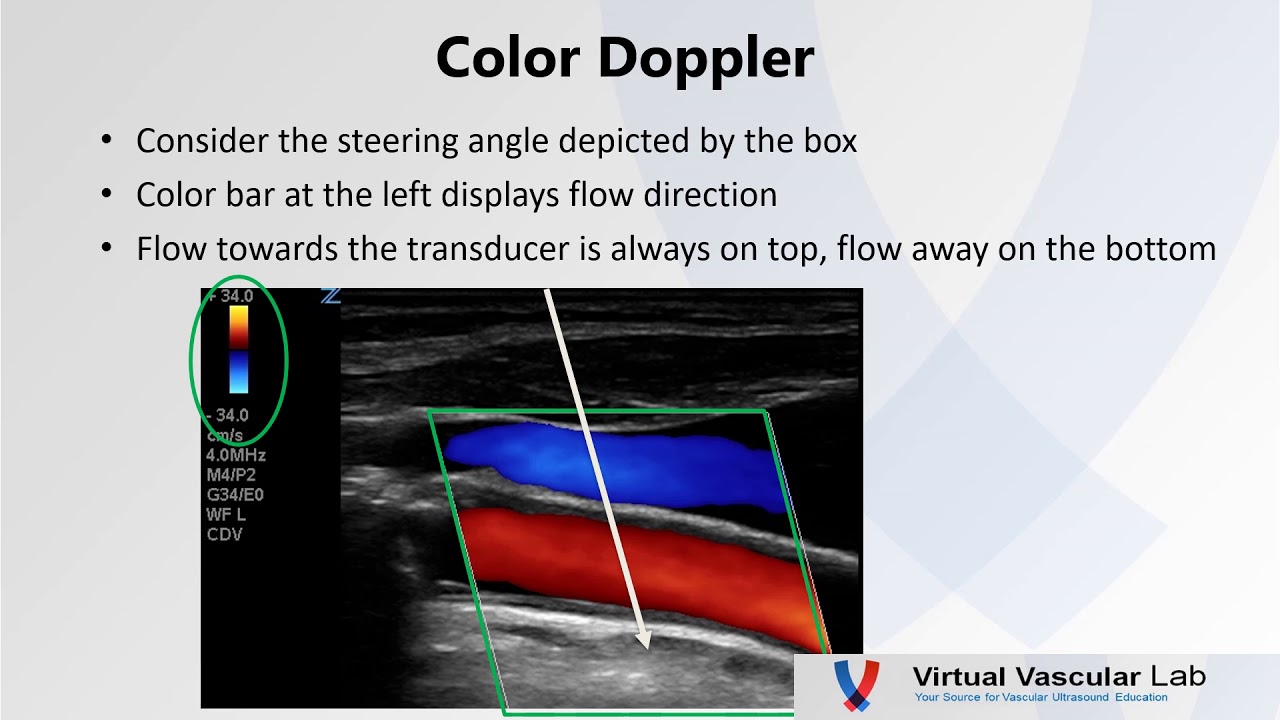 ANGLES - Virtual Vascular Lab Channel