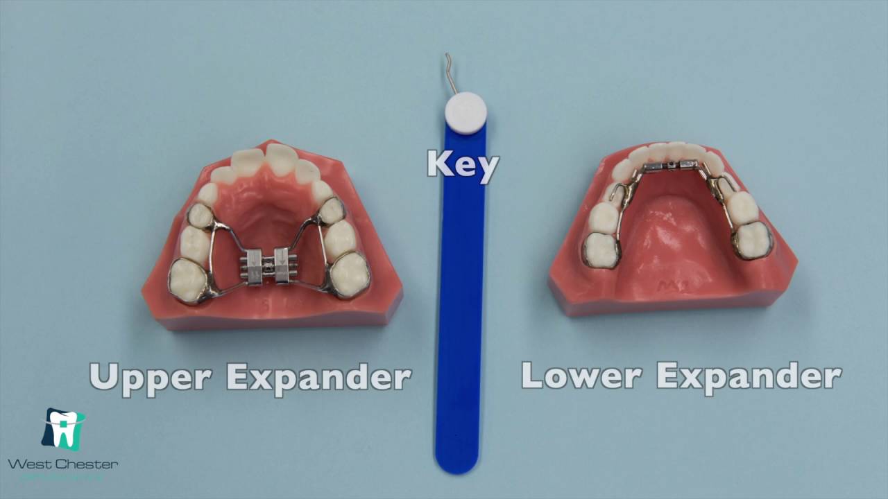 How to Turn an Expander