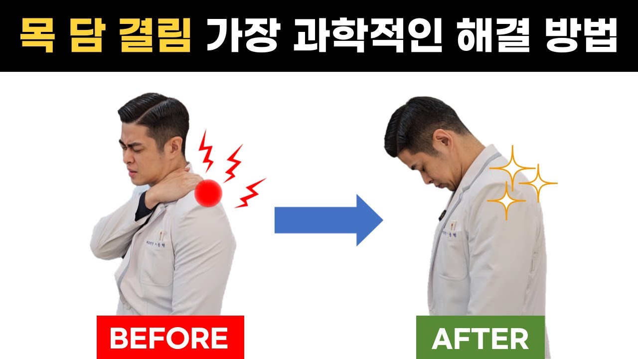 [견갑거근 마사지] 실제 목 담 걸린 상태에서 푸는 과정 즉석에서 보여드립니다
