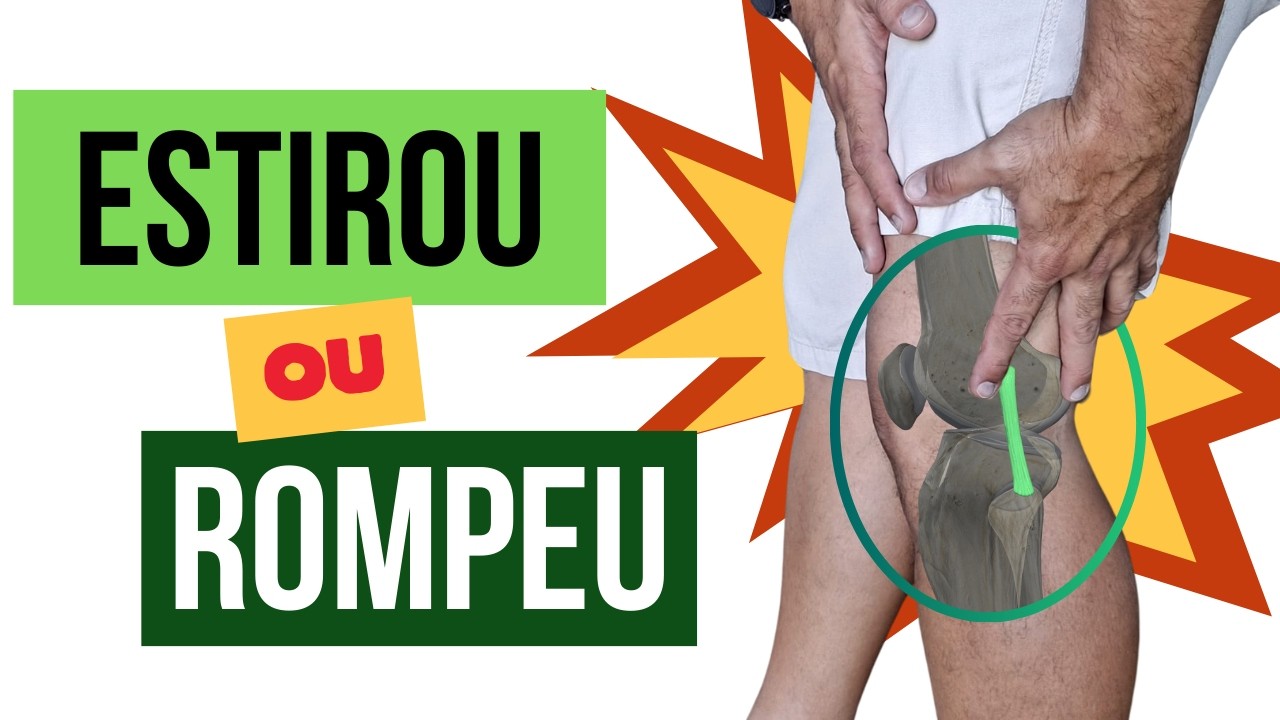 ESTIRAMENTO ou LIGAMENTO ROMPIDO - COMO ALIVIAR