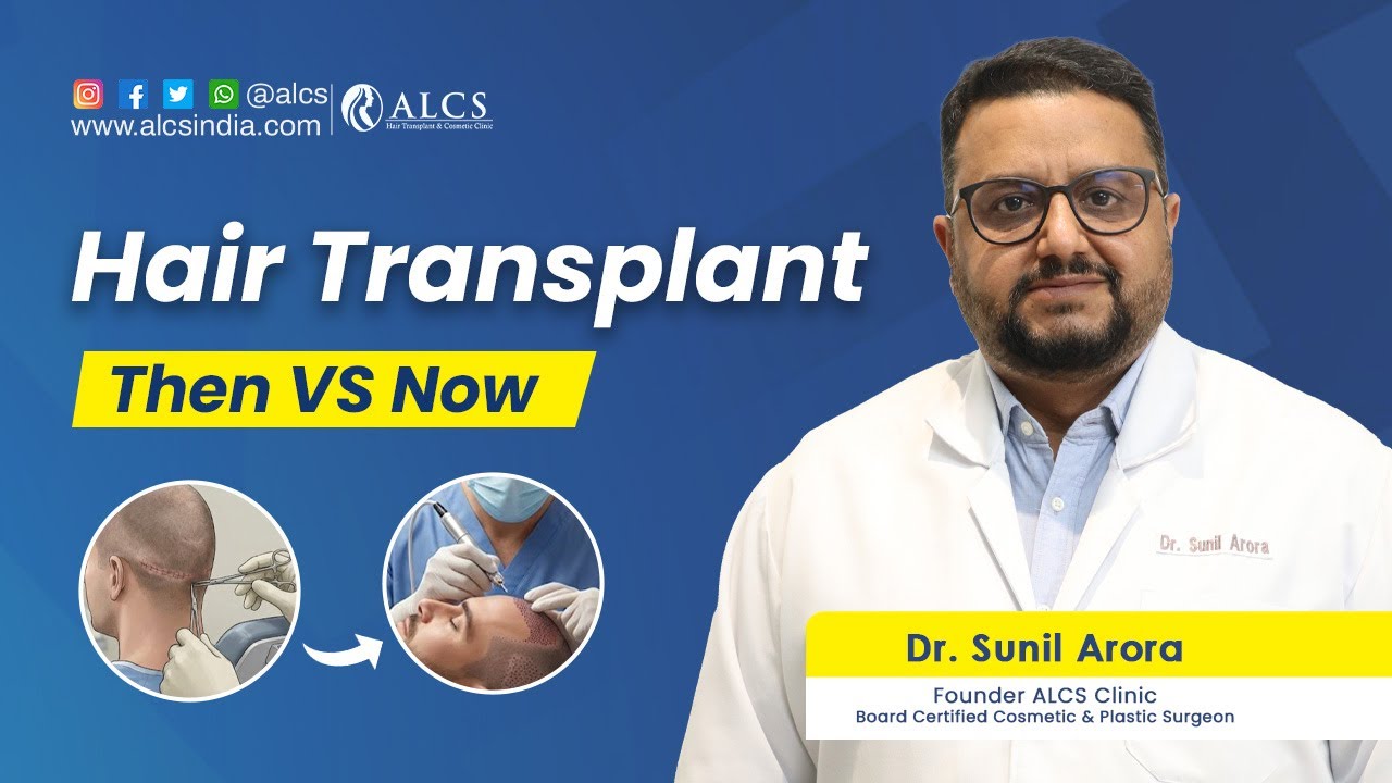 How the field of hair transplant has evolved over the years | Dr. Sunil Arora
