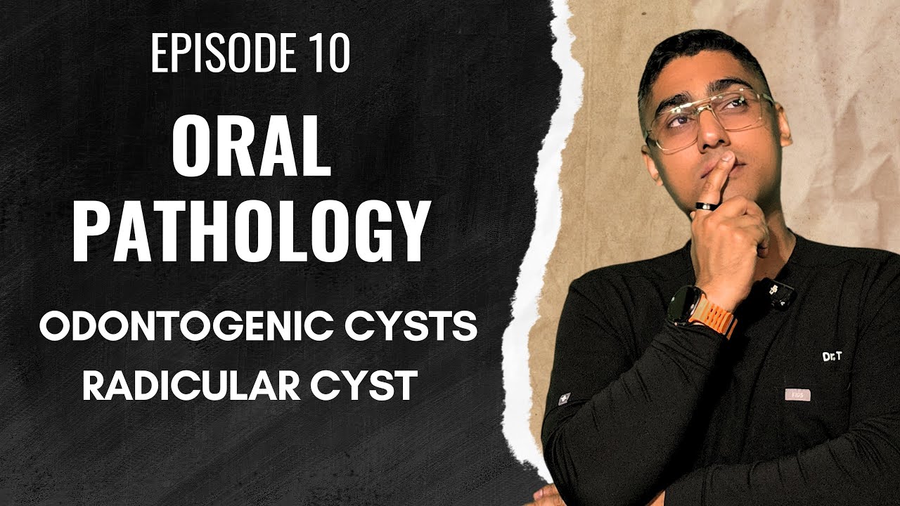 Dental Digest | Oral Pathology | Episode 10 - Radicular Cyst