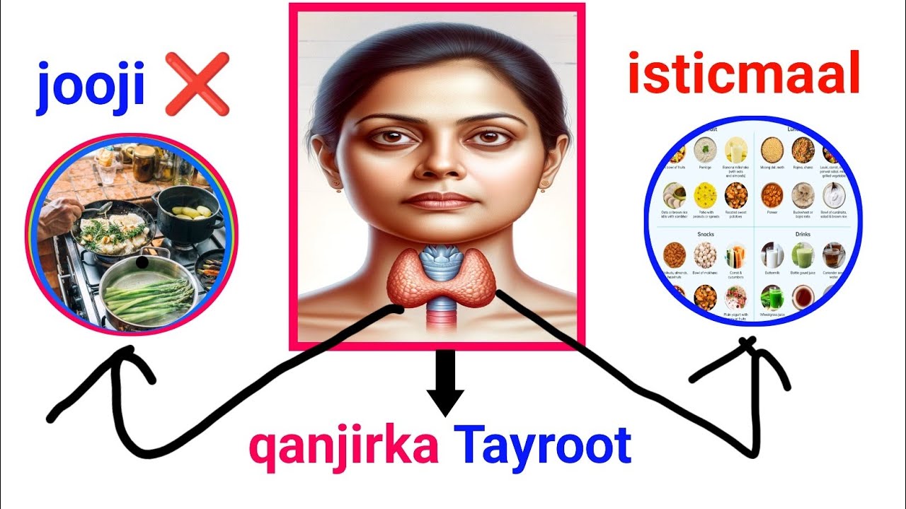 Qanjirka Tayroot ( thyroid gland)  cuntooyinka ufiican iyo kuwa Halista ah kala Baro